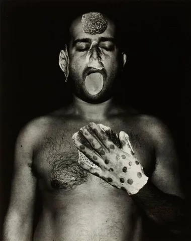 Marc Quinn — Template for my Plastic Surgery